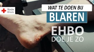 Blaar op de voet Hoe behandel je een blaar  EHBO Doe Je Zo  Rode Kruis [upl. by Grados793]