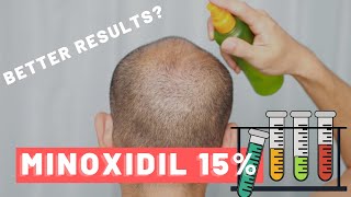 Minoxidil 15  Is It Safe Does It Work Should you use it [upl. by Ave]