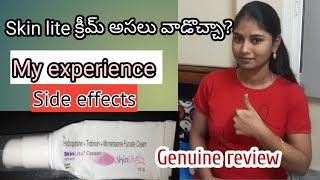 Skin lite cream review in Telugu Genuine review  Skin lightening cream Face cream [upl. by Tnaryb]