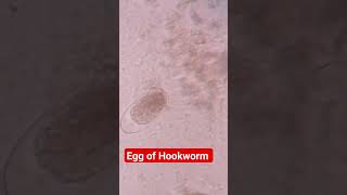 Egg of Hookworm in Stool Microscopy [upl. by Faith973]