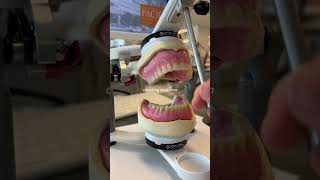 Denture making in prosthodonticsshorts prosthodontics viral trending dentistry bds [upl. by Yleak]