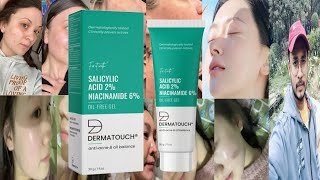 Dermatouch Salicylic Acid Niacinamide Oil Free Gel  Honest Review [upl. by Krueger]