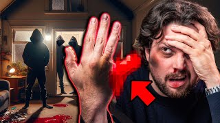 What Happened to Phils Finger My Home Invasion Story [upl. by Tanny]