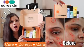 Cureskin App amp Products Review amp Everything In Between  Honest Cureskin Review  Kamna Sharma [upl. by Elane]