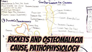 Rickets And Osteomalacia umerfarooqbiology7083 [upl. by Bobinette]