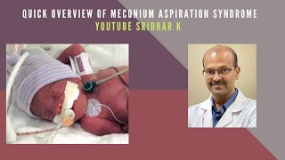 Quick overview of Meconium aspiration syndrome Meconiumaspiration pneumonia neonatology [upl. by Euv]