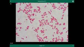 escherichia coli  الإشريكية القولونية [upl. by Girvin149]