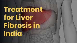 Liver Fibrosis Treatment in India  Treatment for Liver Fibrosis  Lyfboat [upl. by Cave137]