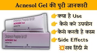 Acnesol Gel Uses  Price  Composition  Dose  Side Effects  Review  in Hindi [upl. by Resaec]