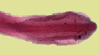 Para GIT  General Characters of Cestoda  Diphyllobothrium latum Fish tape worm  broad tape worm [upl. by Murry]