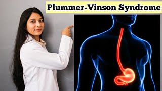 PlummerVinson Syndrome in Hindi  Detail Explanation With Notes  Causes Symptoms Treatment [upl. by Perusse86]