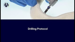 Adin Guidance  How to use  Drilling Protocol [upl. by Llerehc357]