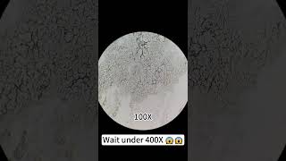 Pimples at 400X magnification are really cool underthemicroscope beefcut scienceshorts [upl. by Tegan]