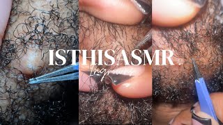 INGROWN HAIR REMOVAL PT 1  INSIDE THE BEARD  ISTHISASMR [upl. by Aehsila]