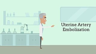 Uterine Fibroid Embolization Fibroids No Surgery Required [upl. by Festatus863]