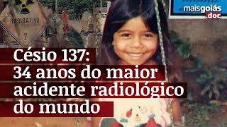 Césio 137 Mais Goiásdoc conversa com vítimas do acidente radiológico de Goiânia [upl. by Eentroc]