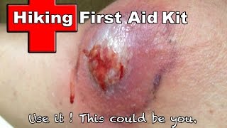 Hiking First Aid Kit  Use it or Else [upl. by Anoyi134]