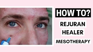 Rejuran Healer Skin Booster Mesotherapy Before And After Ft Vanidiy [upl. by Acirehs]