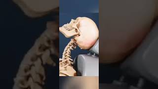 Rear end crash  Whiplash Injury short caraccident education [upl. by Nnylrefinnej]