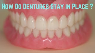 How do dentures stay in place [upl. by Eeryk]