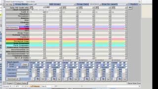 Clinical Flow in TDO Software [upl. by Swithbert]