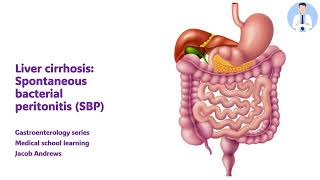 SPONTANEOUS BACTERIAL PERITONITIS [upl. by Marcelia343]