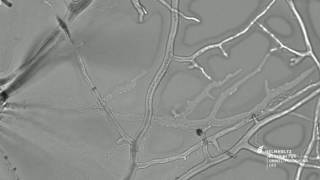 Bacteria on the Fungal Highway Pseudomonas putida moving along hyphae of Cunninghamella elegans [upl. by Nea]