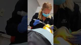 New Dentist with 2 new Fillings 1 [upl. by Lahcar577]