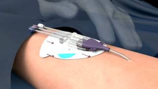 3M™ PICCCVC Securement Device  Tegaderm™ IV Advanced Dressing Product Features [upl. by Pelagi]