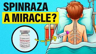 How Does Spinraza Treatment Work  The SMA Victor [upl. by Jeuz]