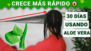 SABILA Para El CRECIMIENTO DEL CABELLO 😱 ANTES Y DESPUÉS  Funciona 🤔 [upl. by Muriah]