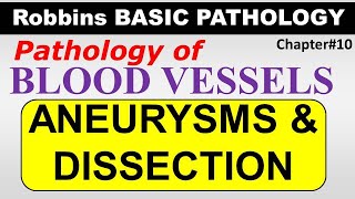 Ch12  Aneurysms amp Dissection  Blood Vessel Pathology  Robbins Lectures [upl. by Critchfield]