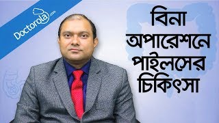 Piles treatment without surgery  Hemorrhoid Removal  অপারেশন ছাড়া পাইলস এর চিকিৎসা  Piles [upl. by Jemina]