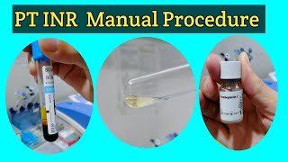 PT INR Manual Procedure Prothrombin Time Test PT Manual Test PT Manual Procedure in Urdu amp Hindi [upl. by Anauqat]