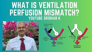 What is ventilationperfusion VQ mismatch How do we manage it neonatalventilation VQmismatch [upl. by Eneloc361]