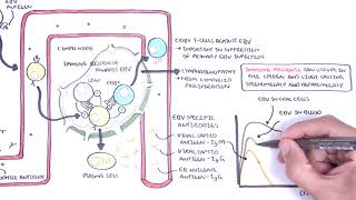 Epstein Barr Virus and Infectious Mononucleosis pathophysiology investigations and treatment [upl. by Ardnaek241]