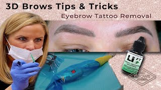 Eyebrow Tattoo Removal using Saline solution [upl. by Elleiand]