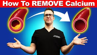 How To REMOVE Calcium From Your Arteries Top 15 Vitamin K2 Foods [upl. by Durer]