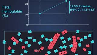 Hydroxyurea for Sickle Cell Anemia [upl. by Shimberg31]