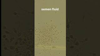 Semen fluid examination [upl. by Gnoht]