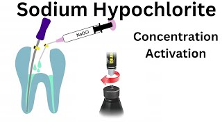 Sodium Hypochlorite Irrigation in Endodontics Part 1 Advantage Disadv Concentration amp Activation [upl. by Tamberg]