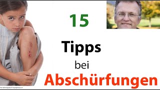 15 Tipps bei Abschürfungen [upl. by Aracal]