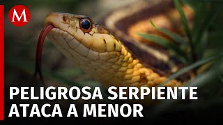 En Chiapas menor fue amputado de su pie tras ser atacado por una serpiente [upl. by Haduj]