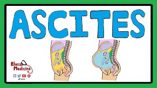 ASCITES  Serum Ascites Albumin Gradient SAAG  Ascites Pathophysiology  Ascites Causes [upl. by Yllitnahc421]