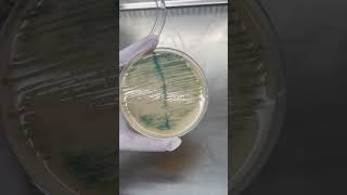 Burkholderia cepacia Trên Môi Trường Thạch UTI  Điều Bạn Cần Biết shorts labinsight [upl. by Shirley]