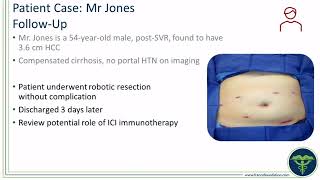 Expert Perspectives The Role of Immunotherapy in Advancing the Treatment of HCC and BTC [upl. by Loux]