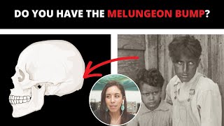 5 Common Traits of Melungeon Descent [upl. by Gary468]