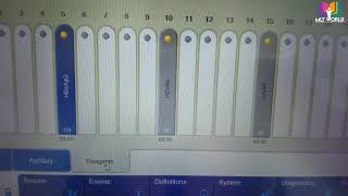 Liason diasorin machineHow to use machineall details for new operatorsScreen specifications [upl. by Madaras]