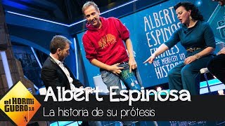 Albert Espinosa y su emotiva historia de la prótesis dedicada a El Hormiguero  El Hormiguero 30 [upl. by Suollecram684]