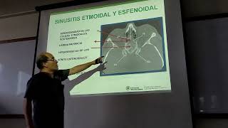 42 Patología de los SPN órbitas y hueso temporal [upl. by Nnaeoj]